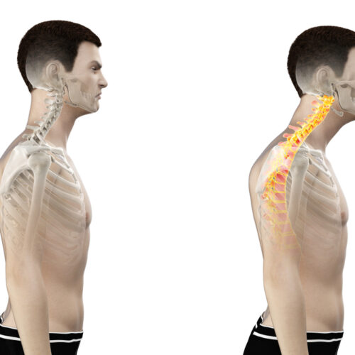 Neck Pain Specialist Melbourne | Non Surgical Spinal Care